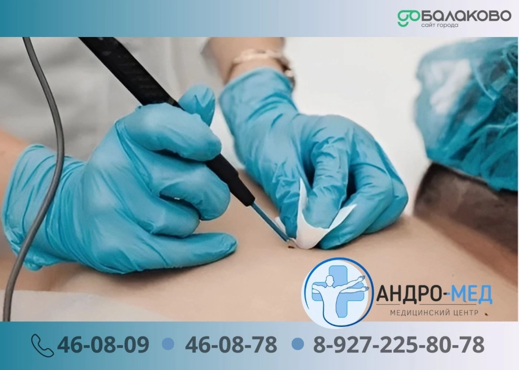 Андромед 14.jpg Андромед 14.jpg